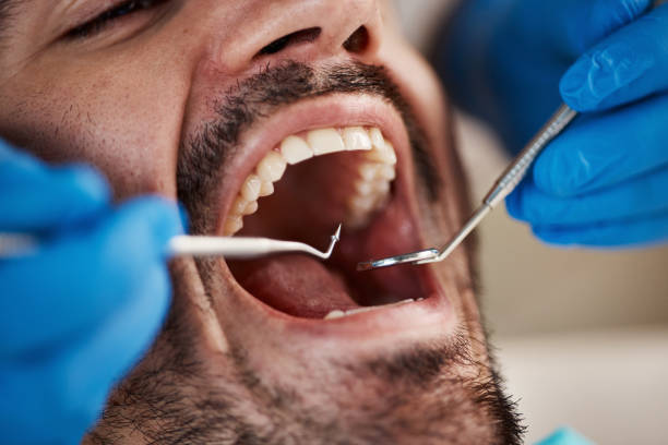 Best Emergency Tooth Extraction in Maan, ND